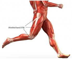 IT Band Syndrome