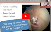 Learning
              Curve In Hip Arthroscopy, Dr. Itamar Botser, Chicago Hip Symposium