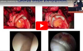 Labrum:
              Anatomy and Function, Dr. Benjamin Domb, Chicago Hip Symposium (2013)