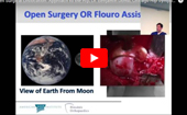 Open
              Surgical Dislocation: Approach to the Hip, Dr. Benjamin Domb, Chicago Hip Symposium (2013)